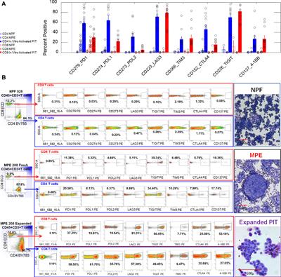 A maladaptive pleural environment suppresses preexisting anti-tumor activity of pleural infiltrating T cells